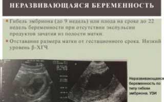 Признаки замершей беременности на 15 неделе
