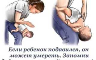 Ребенок подавился водой что делать