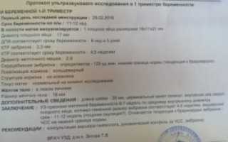 Нгд Не Выявлено При Беременности Что Это