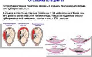 Толстая плацента при беременности причины и последствия