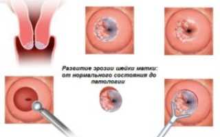 Выделения при беременности после осмотра шейки матки при беременности